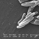 Mycobacterium tuberculosis 8438 lores